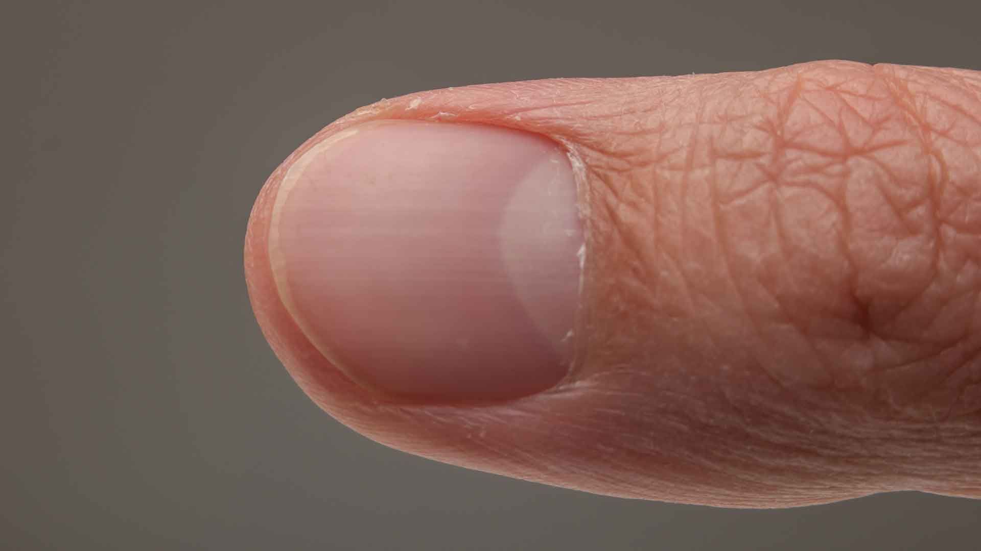 What your fingernails can reveal about your health