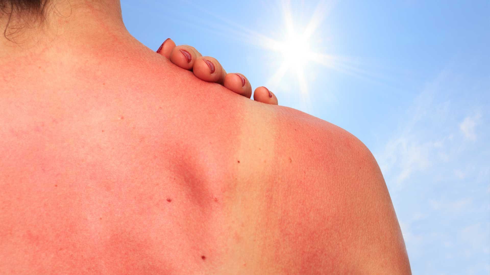 Reduce Cancer Risk: Avoid These Risk Factors