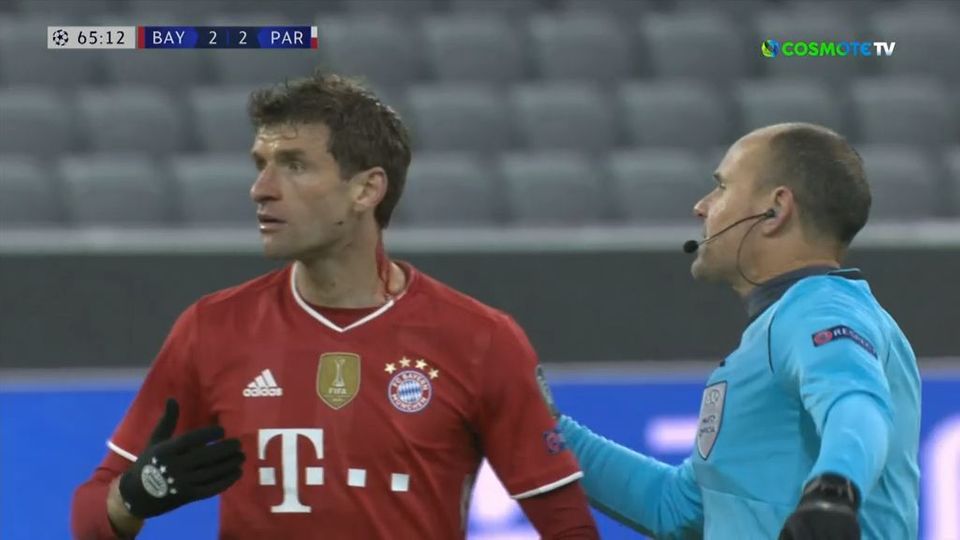 Live Streaming Pari Mpagern