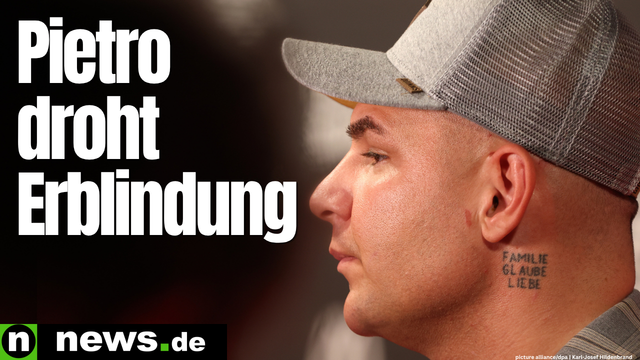 Pietro Lombardi in great concern: Singer has lost 60 percent of his eyesight - he faces blindness