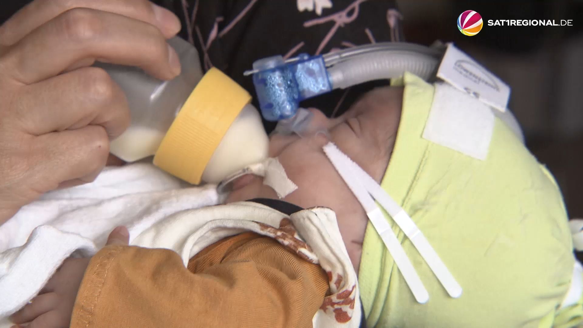 Frauenmilchbank vom UKE ermöglicht Frühgeborenen die Versorgung mit Muttermilch